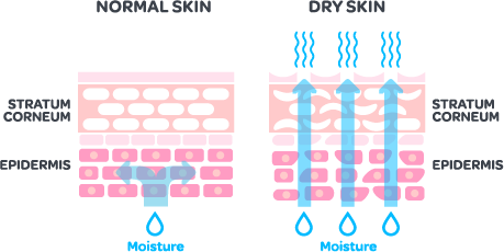 Grafik_dry skin.png