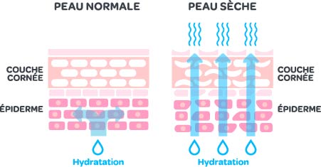 Grafik_TrockeneHaut_RGB_FR.jpg