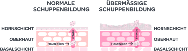 Schuppenbildung der Haut