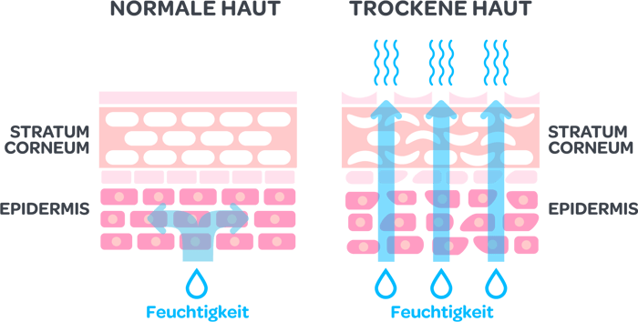 Trockene Haut einfach erklärt