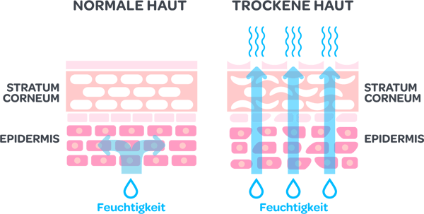Trockene Haut einfach erklärt