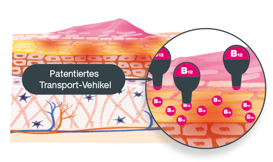 Mavena_Neurodermitis_Patentiertes Transport-Vehikel