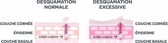 Mavena_Schuppenbildung_FR